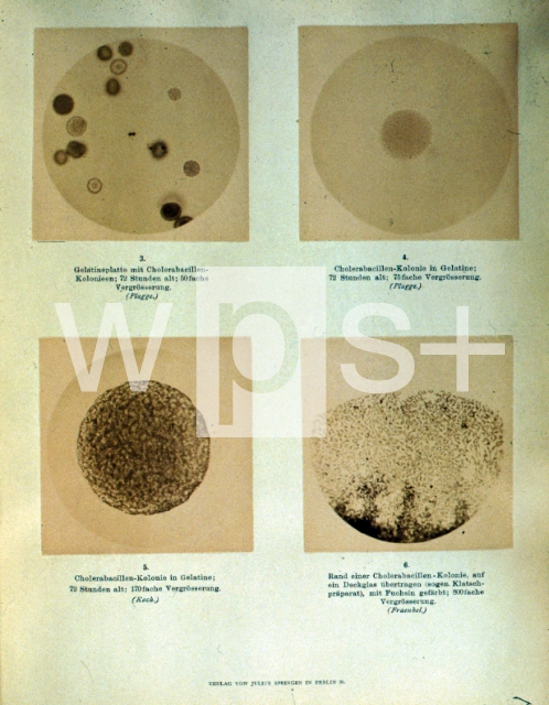 ｜コッホのコレラ菌の顕微鏡写真の原図