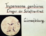 ｜コッホが描いた寄生性原虫、トリパノソーマ