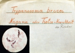 ｜コッホが描いた寄生性原虫、トリパノソーマ