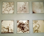 ｜コッホの細菌の顕微鏡写真の原図